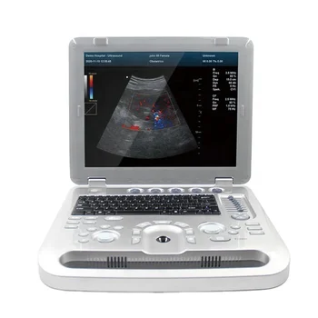 CMS1700A Медицинский цветной допплеровский 4D объемный ультразвуковой аппарат Сканер беременности с 4D объемным зондом Диагностическое устройство