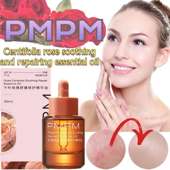 Эссенция PMPM Centifolia Rose Essence Oil Для чувствительной кожи Поддерживает Стабильность и восстанавливает склонную к акне и покраснению кожу 30 мл